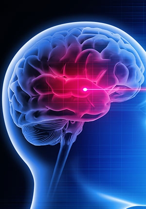 How to Recognize and Address Cognitive Changes After TBI